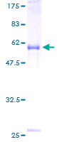 12.5% SDS-PAGE Stained with Coomassie Blue.